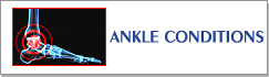 Ankle Conditions Information - Birmingham Orthopaedic Foot and Ankle Clinic